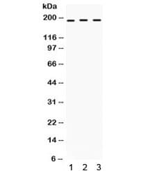 Polyclonal Rabbit anti-Human CD118 / LIF Receptor Alpha Antibody (WB)