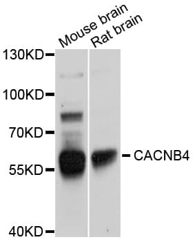 CACNB4 Antibody
