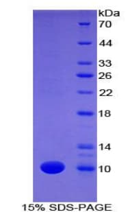 Mouse FBLN5 / Fibulin 5 Protein (Recombinant His)