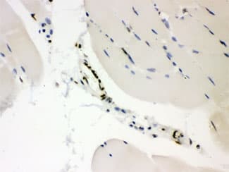 CTBP2 Antibody