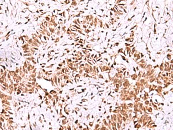 Polyclonal Rabbit anti-Human ISY1-RAB43 Antibody (IHC, WB)