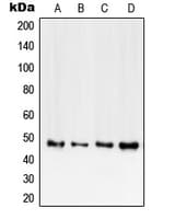 TNFRSF1B / TNFR2 Antibody (C-Terminus)