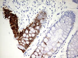 Monoclonal Mouse anti-Human KRT20 / CK20 / Cytokeratin 20 Antibody (clone OTI2A2, IHC, WB)