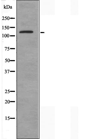 DRPLA / Atrophin-1 Antibody