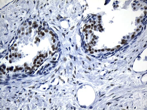 AR / Androgen Receptor Antibody (aa420-659, clone UMAB240)