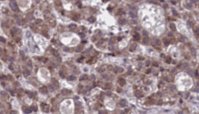 ADGRE1 / EMR1 Antibody (aa826-876)