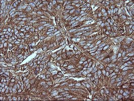 MAP2K1 / MKK1 / MEK1 Antibody (clone OTI4F1)