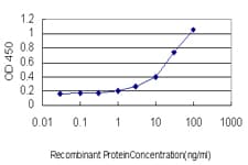 SGK1 / SGK Antibody (clone 4D7-G3)