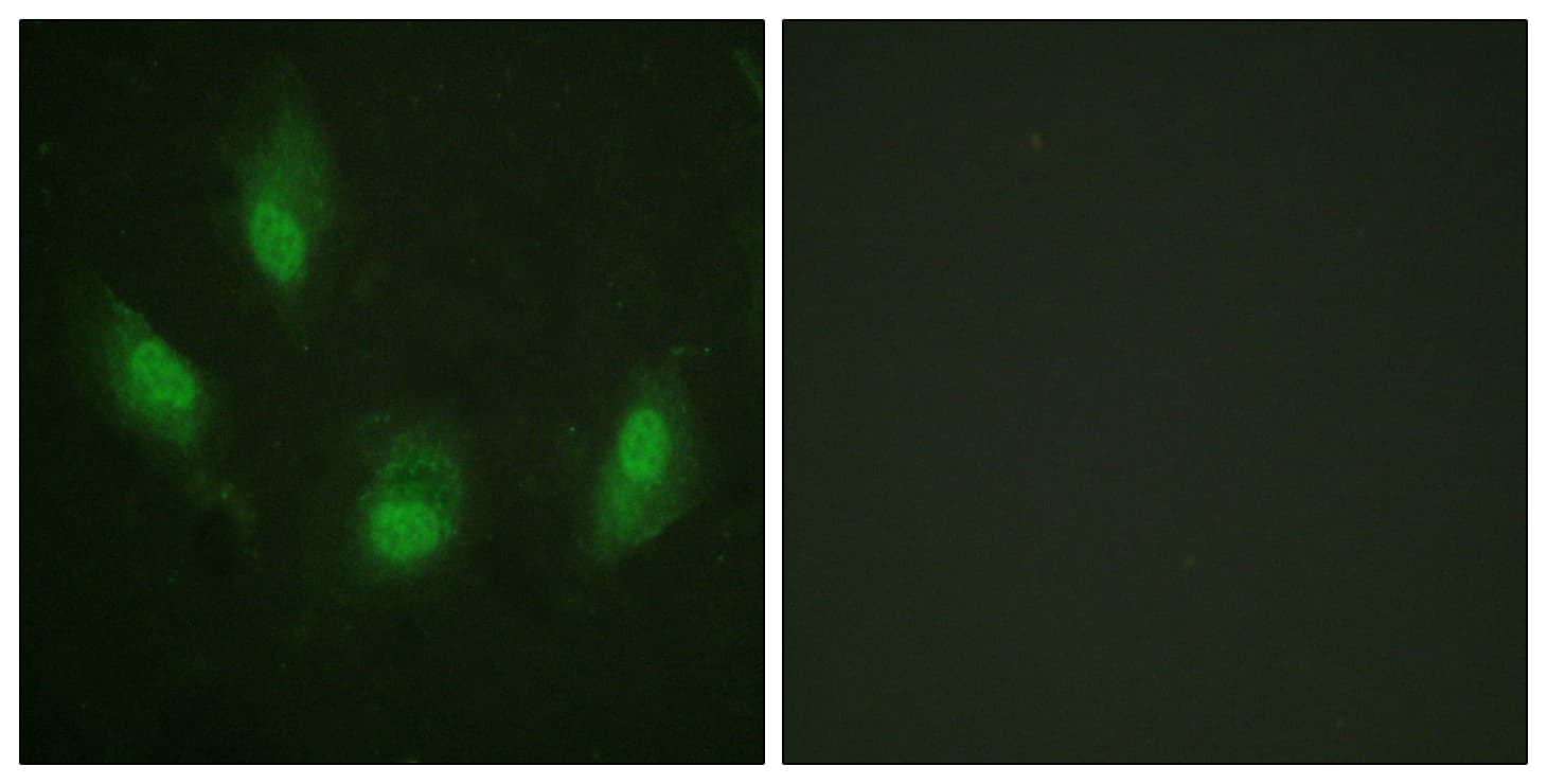 IHC-plus™ TP53 / p53 Antibody (aa344-393)