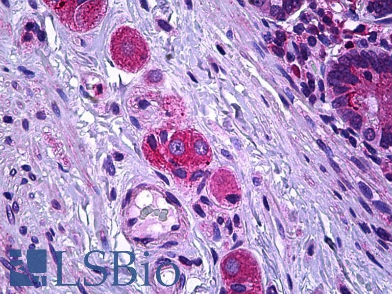 IHC-plus™ SSBP2 Antibody (aa10-59)