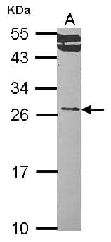 Polyclonal Rabbit anti-Human RALA / RAL Antibody (aa1-206, WB)