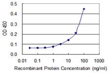 CASQ1 / Calsequestrin 1 Antibody (clone 1D7)