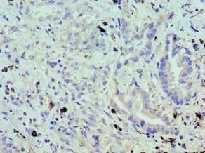 UBC6 / UBE2J2 Antibody (aa1-230)