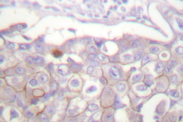 CLDN4 / Claudin 4 Antibody (Pro192)