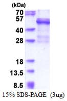 Human CTSW / Cathepsin W Protein (Recombinant His)