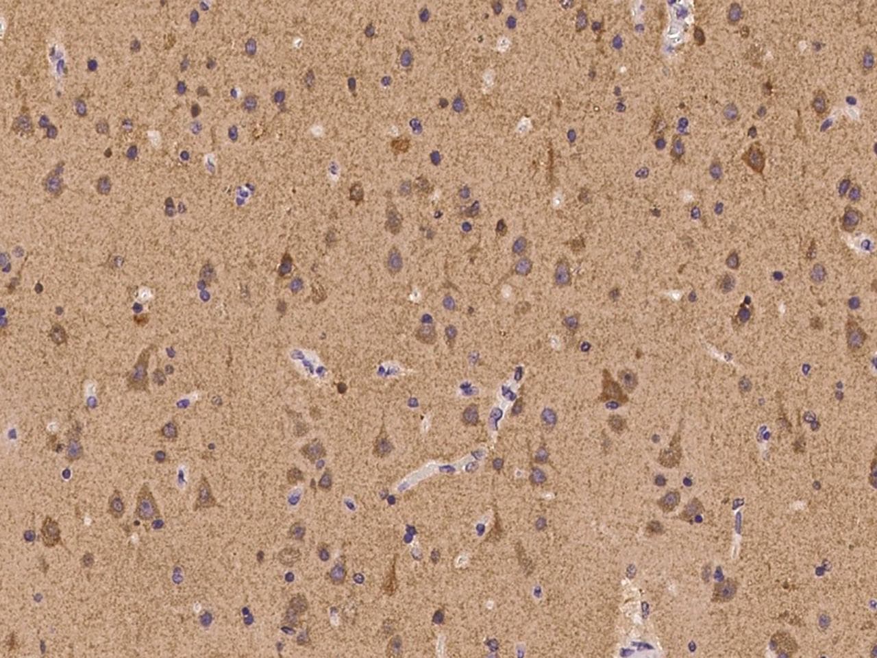Polyclonal Rabbit anti-Human ATP6V1F Antibody (IHC, IF)
