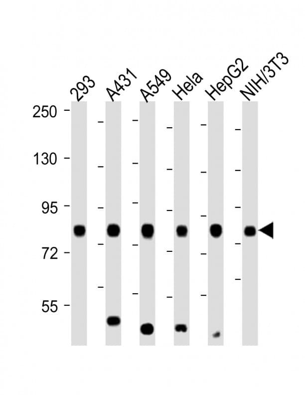 RPS6KA3 / RSK2 Antibody