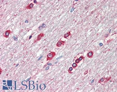 IHC-plus™ RTN3 / Reticulon 3 Antibody (clone 1E+11)