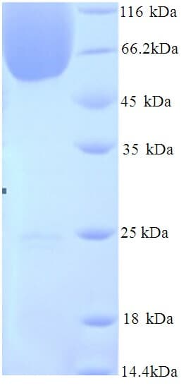 Mouse BAG3 / BAG-3 Protein (Recombinant 6His, N-terminus)