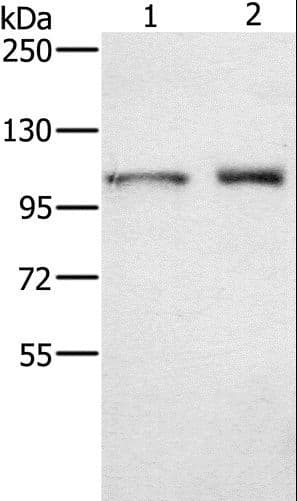 Polyclonal Rabbit anti-Human ODF2 Antibody (IHC, WB)