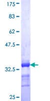 Human EEA1 Protein (Recombinant GST, N-terminus)