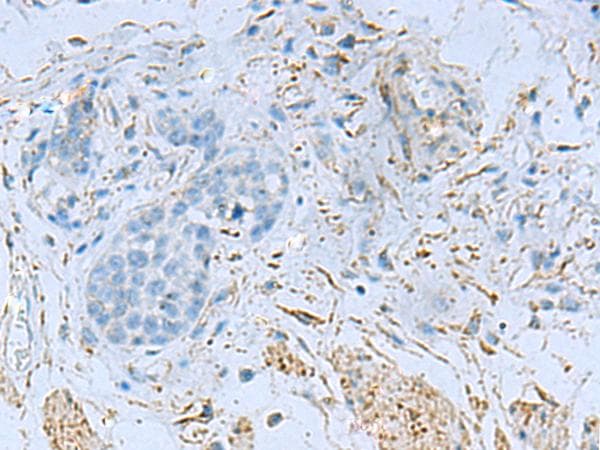 Polyclonal Rabbit anti-Human DPYSL3 / CRMP4 Antibody (IHC)