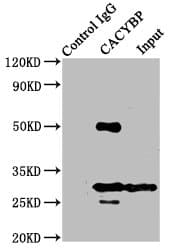 CACYBP Antibody