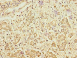 RANBP3 Antibody