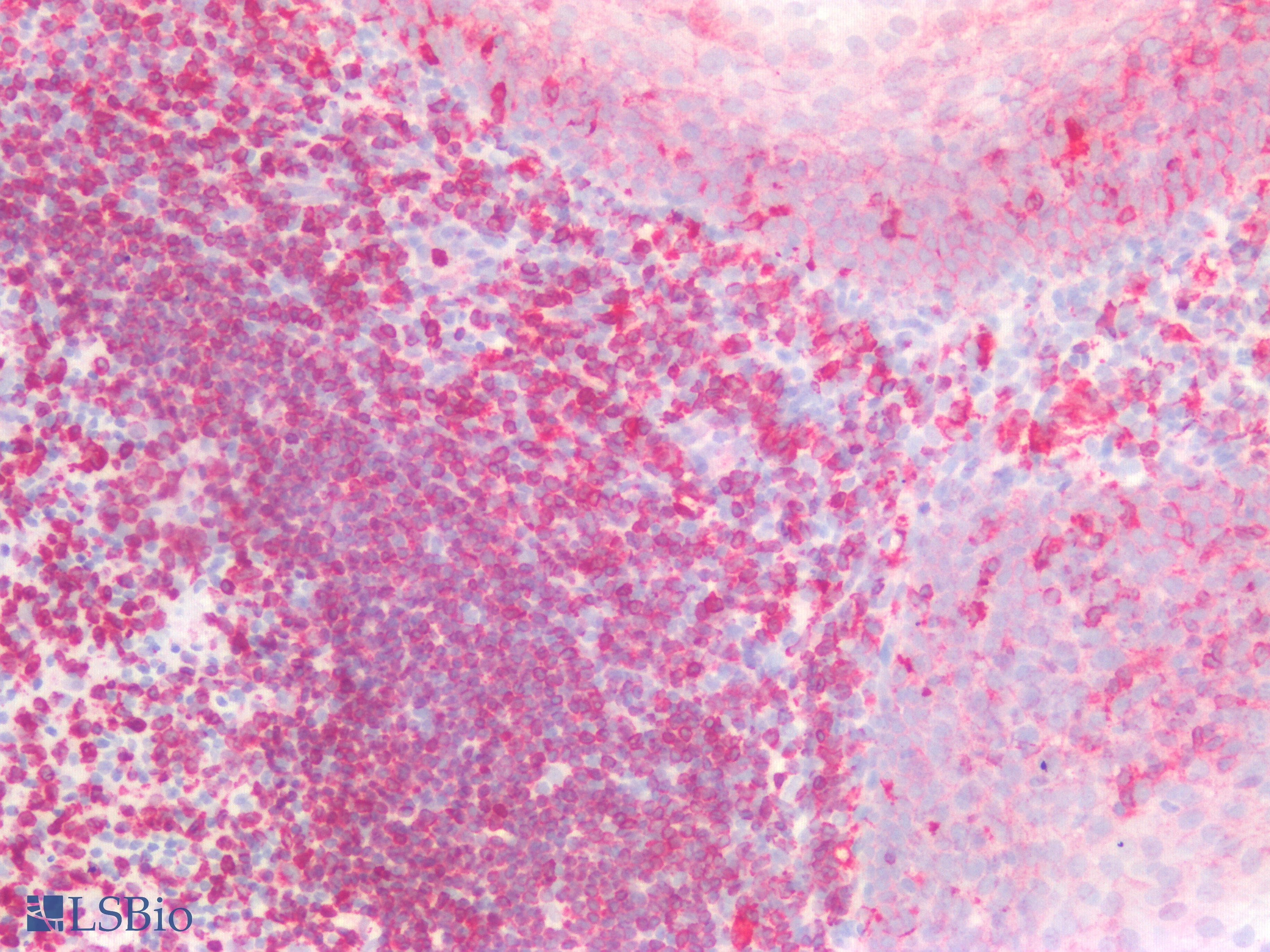 PathPlus™ SDC1 / Syndecan 1 / CD138 Antibody