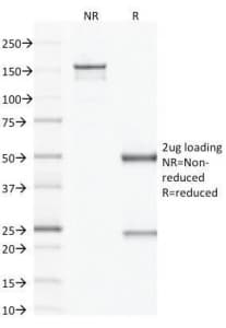 F13A1 / Factor XIIIa Antibody (clone F13A1/1683, Azide-free, BSA-free)