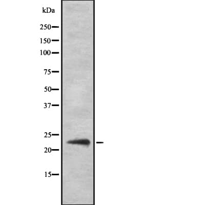 Polyclonal Rabbit anti-Human SOCS2 Antibody (IF, WB)