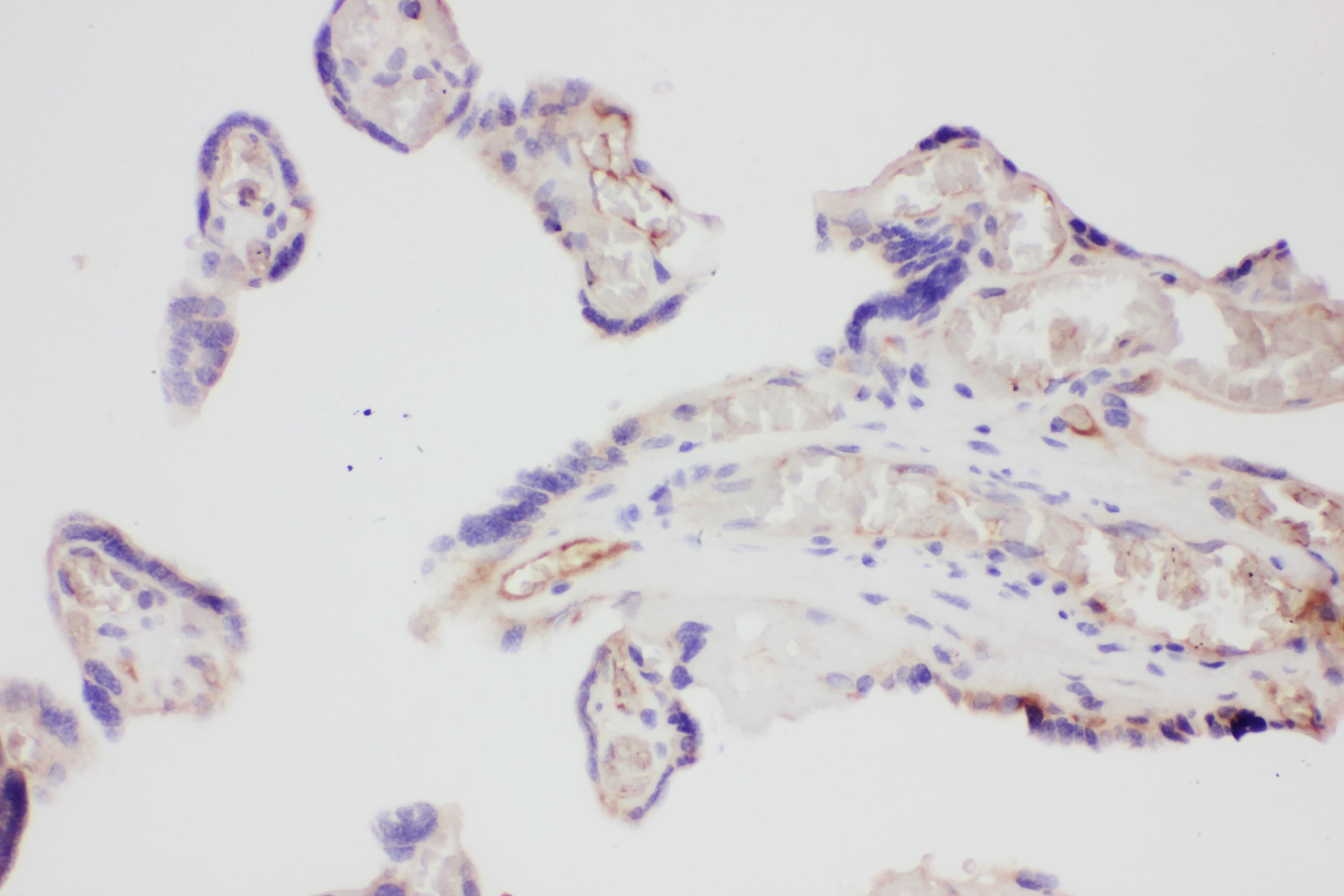 Polyclonal Rabbit anti-Human VEGFA / VEGF Antibody (aa27-191, IHC, WB)