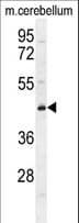 CYB5D2 Antibody (aa187-216)