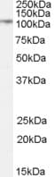 DPP4 / CD26 Antibody (Internal Region)