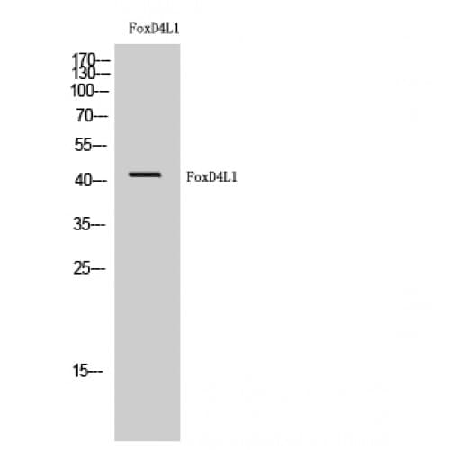 Polyclonal Rabbit anti-Human FOXD4L1 / FOXD5 Antibody (320-400 aa, C-terminal, WB)