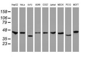 CBX8 Antibody (clone OTI6G4)