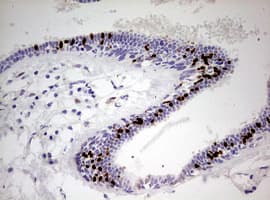 Monoclonal Mouse anti-Human PR / Progesterone Receptor Antibody (clone OTI2E2, aa1-298, IHC, WB)