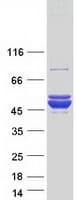 Human ACOT9 Protein (Recombinant Myc-DDK (Flag))