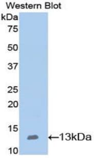 NPHS1 / Nephrin Antibody (aa39-144)