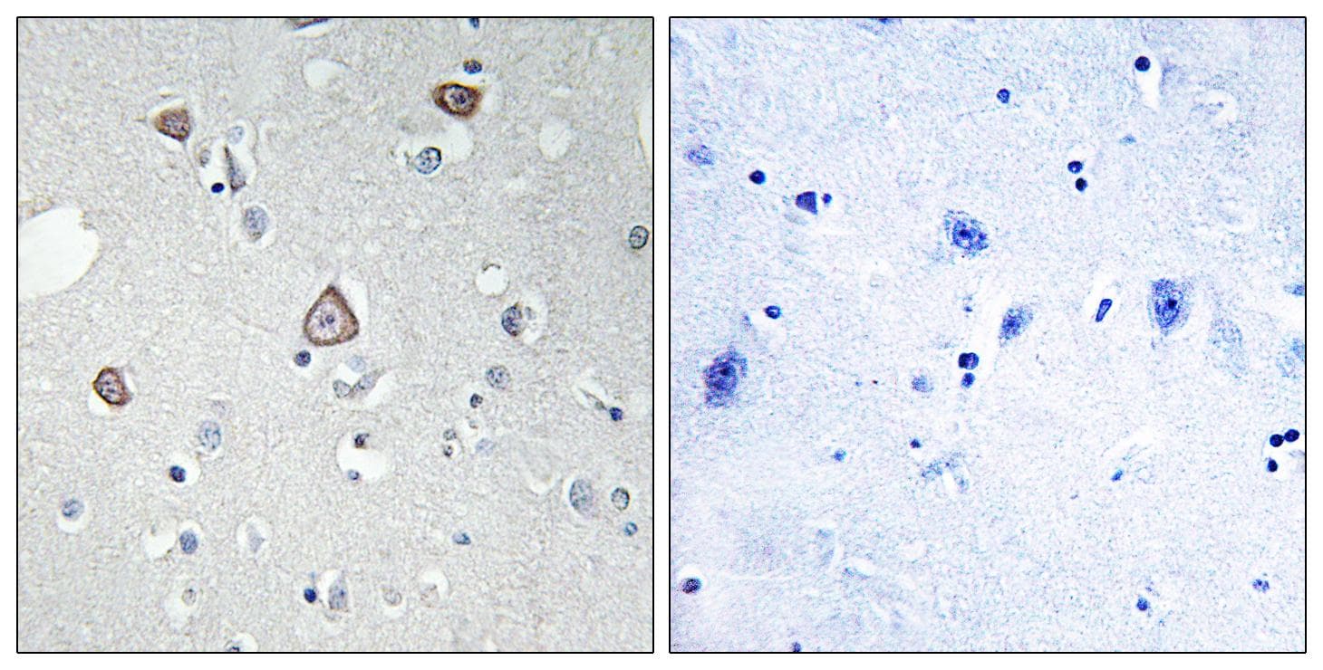 GRM2 / MGLUR2 Antibody