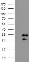 Monoclonal Mouse anti-Human RBPMS / Hermes Antibody (clone OTI2C3, IHC, WB)