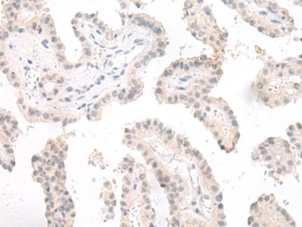 GHDC Antibody