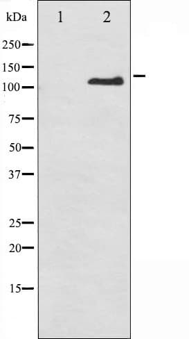 ITGB3 / Integrin Beta 3 / CD61 Antibody (phospho-Tyr785)