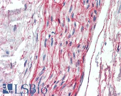 IHC-plus™ MFAP5 / MAGP2 Antibody (aa22-173)