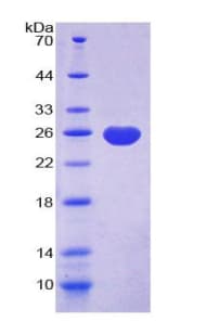 Rabbit ORM1 / Orosomucoid Protein (Recombinant His-T7)