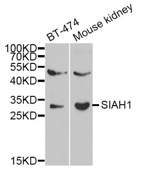 SIAH1 Antibody