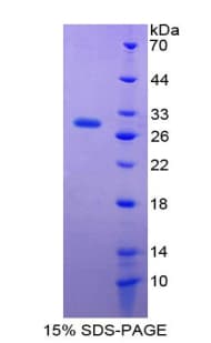 Rat ITGAD / CD11d Protein (Recombinant His-T7)