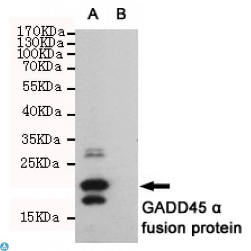GADD45A / GADD45 Antibody