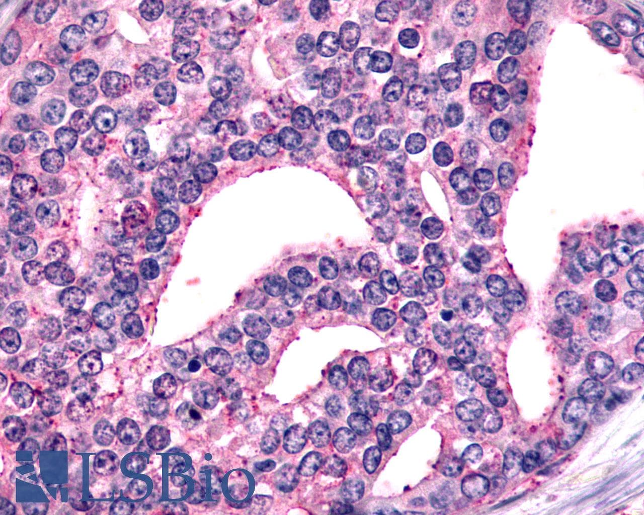 PathPlus™ GRM6 / MGLUR6 Antibody (N-Terminus)