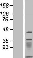 MOCS2 Protein (Over-Expression Lysate Myc-DDK (Flag))